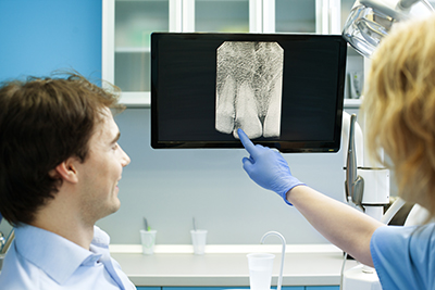 When Do You Need a Dental X-ray