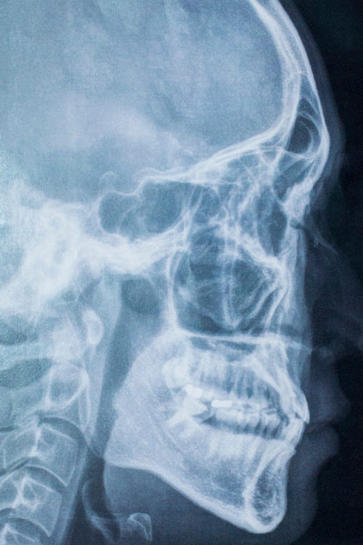 Dental imaging scan of head and teeth