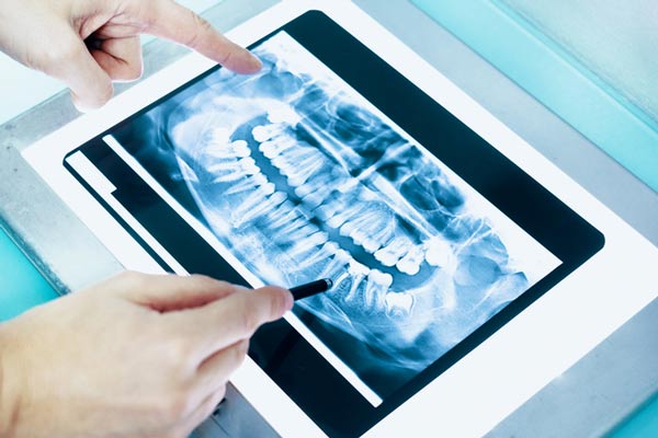 Dental x-ray of a full mouth.