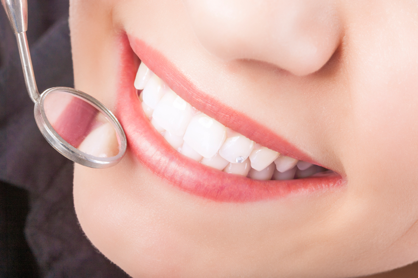 Everything you need to know about dental sealants?